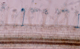 Visualisation de la racine et de ses poils absorbants. Les bacteries symbiotiques, Sinorhizobium meliloti apparaissent dans les cordons d'infections, avant l'apparition du nodule.